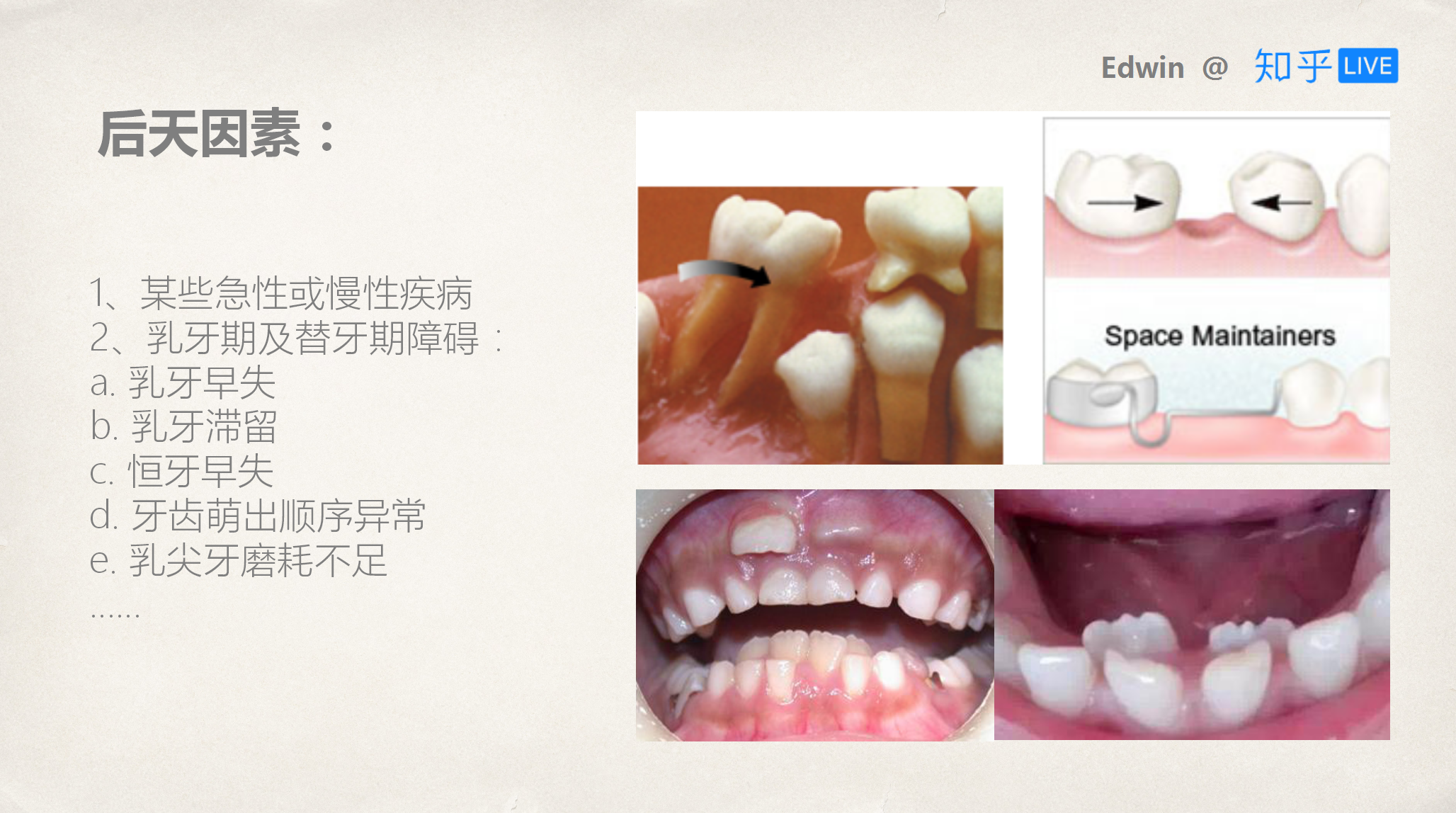 牙齒窩溝封閉是什么意思